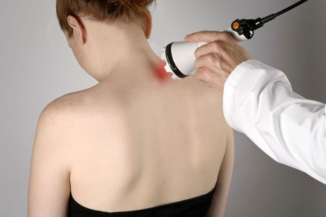 tratamento fisioterápico da osteocondrose cervical