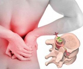 Lumbago no início da doença osteochondrosis