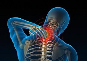 Por que se desenvolve e como a osteocondrose cervical se manifesta