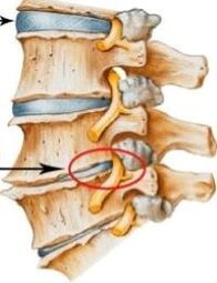 osteocondrose da coluna cervical